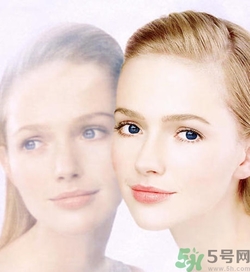 曬斑可以自己消退嗎？曬斑可以用激光去除嗎？