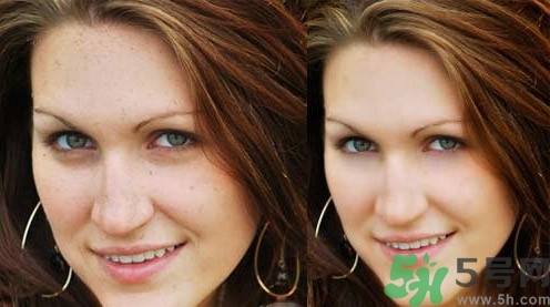 色斑會自己消失嗎？色斑遺傳嗎？