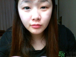 天生腫眼泡怎么消除？天生腫眼泡怎么辦？