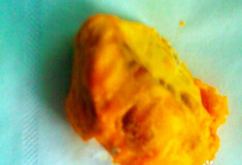 雞蛋果怎么吃？雞蛋果的籽可以吃嗎？