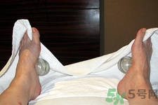 腳底可以拔罐嗎？腳底拔火罐有什么好處？