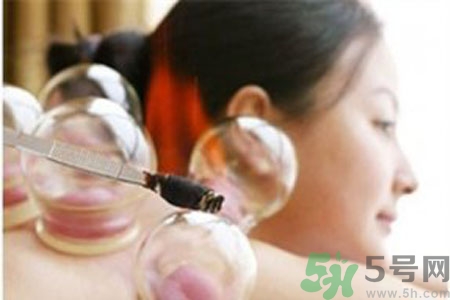 肩膀酸痛可以拔火罐嗎？孕婦肩膀酸痛能拔火罐嗎？