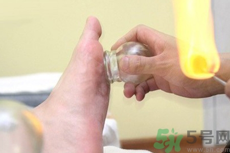 腳底拔罐能去濕氣嗎？腳底拔罐出現(xiàn)青紫正常嗎？