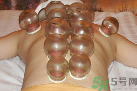 老人能在家拔火罐嗎？老年人拔火罐需要注意什么？