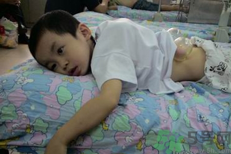 小孩可以拔罐嗎？寶寶能拔火罐嗎？