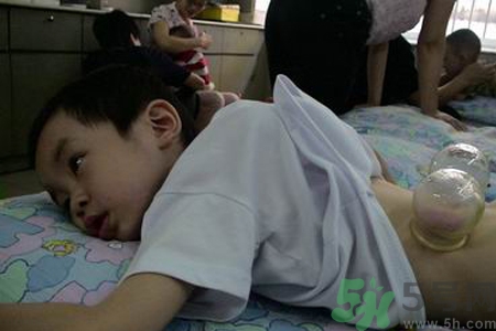 小孩可以拔罐嗎？寶寶能拔火罐嗎？