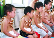 小孩可以拔罐嗎？寶寶能拔火罐嗎？