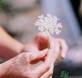 手指被門夾了有淤血怎么辦？手指被門夾了有淤血怎么處理？