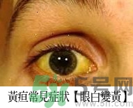 上腹部不舒服有時疼痛會不會是胰臟癌？