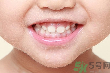 小孩牙齒發(fā)黑怎么回事？小孩牙齒發(fā)黑怎么辦？