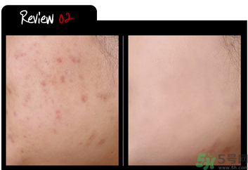 w.lab雪花氣墊黑色款怎么樣？w.lab雪花氣墊黑色和白色區(qū)別？