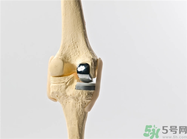 膝關(guān)節(jié)疼痛是怎么回事該怎么辦？膝關(guān)節(jié)疼痛如何治療？