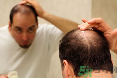 掉頭發(fā)需要檢查什么？脫發(fā)需要做什么檢查？