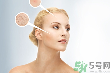 甘油會(huì)堵塞毛孔嗎？甘油堵塞毛孔怎么辦？