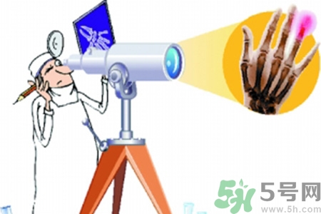 什么年齡測骨齡最好？如何測骨齡？