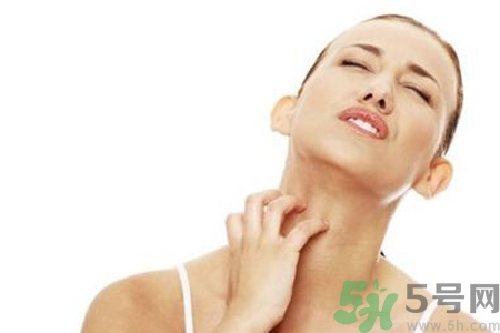 臉過(guò)敏發(fā)紅癢怎么辦？臉過(guò)敏發(fā)紅癢擦什么藥好？