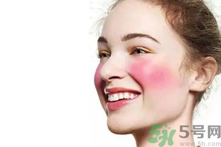 臉過(guò)敏發(fā)紅癢怎么辦？臉過(guò)敏發(fā)紅癢擦什么藥好？