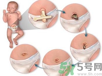 新生兒肚臍可以碰水嗎？新生兒肚臍沒脫落能洗澡嗎？