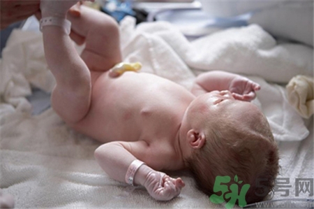 新生兒肚臍怎么護理？新生兒肚臍什么時候掉？