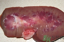 輕度酒精肝能治好嗎?輕度酒精肝吃什么藥 輕度酒精肝能治好嗎?輕度酒精肝吃什么藥