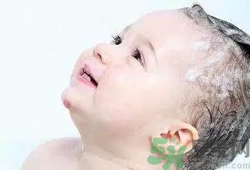 寶寶頭垢是如何產(chǎn)生的？寶寶頭垢怎么去掉？