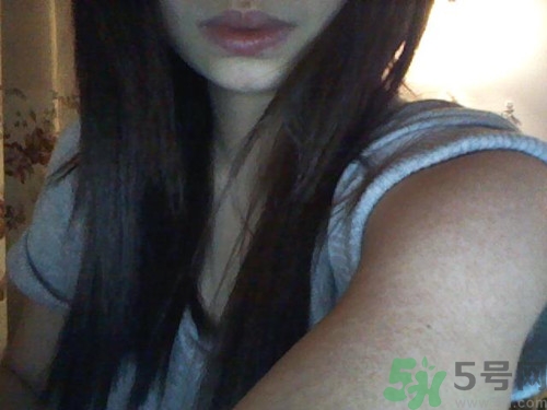 雞皮膚可以根治嗎?雞皮膚怎么消除最有效 雞皮膚可以根治嗎?雞皮膚怎么消除最有效