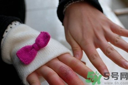 冬天長凍瘡怎么辦？冬天手上長凍瘡怎么辦？