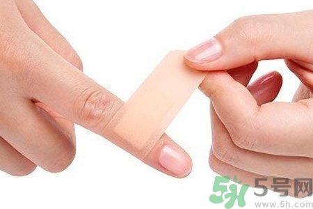 長凍瘡可以擦風油精嗎？風油精對凍瘡真的有效嗎？