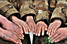 怎樣提前預(yù)防凍瘡比較有效？冬天預(yù)防凍瘡的小妙招