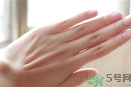 患凍瘡是身體缺什么嗎？長(zhǎng)凍瘡是身體缺維生素嗎？