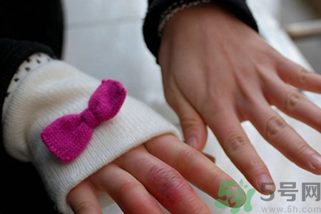 手上凍瘡癢怎么辦？腳生凍瘡很癢怎么辦？