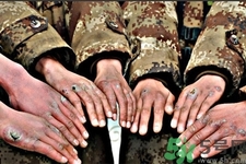 生凍瘡吃什么食物最好？預(yù)防凍瘡吃什么最有效？