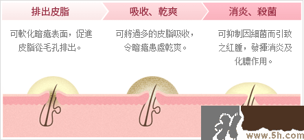 日本白兔牌暗瘡膏價(jià)格 白兔祛痘膏多少錢？