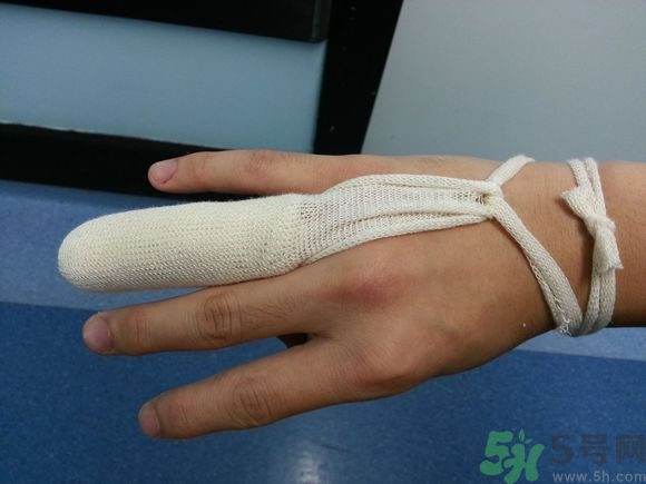 手被門(mén)夾了有淤血怎么辦?手被門(mén)夾了怎么緩解疼痛 手被門(mén)夾了有淤血怎么辦?手被門(mén)夾了怎么緩解疼痛