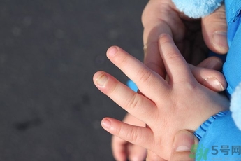 手被門(mén)夾了有淤血怎么辦?手被門(mén)夾了怎么緩解疼痛 手被門(mén)夾了有淤血怎么辦?手被門(mén)夾了怎么緩解疼痛