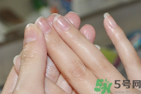 ?指甲上有豎紋是缺什么？指甲上有豎紋是缺維生素嗎？