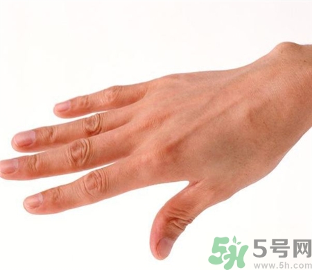 手背發(fā)黑是怎么回事?手背變黑是什么原因? 手背發(fā)黑是怎么回事?手背變黑是什么原因?