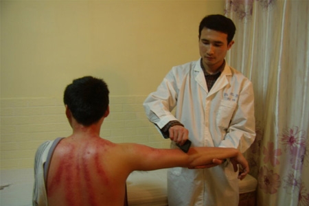 刮痧是什么原理？刮痧后需要注意什么？