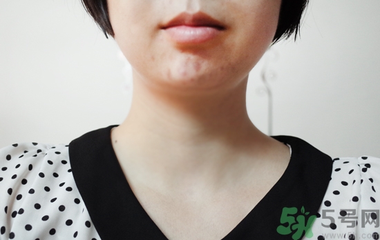 夢詩肌面霜怎么樣?dream skin面霜好用嗎? 夢詩肌面霜怎么樣?dream skin面霜好用嗎?