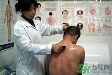 背部刮痧多久做一次比較好？刮痧經(jīng)常做會有依賴性嗎？