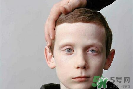 老年人為什么容易得面癱？老年人面癱原因有哪些？