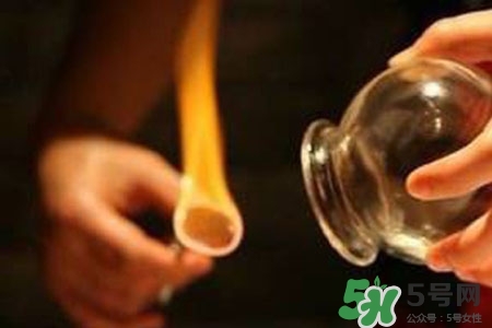 拔罐放血對(duì)身體好嗎？拔罐放血有什么好處？