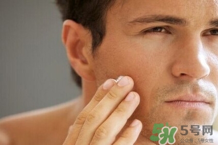 男人臉上酒刺怎么去掉？臉上長(zhǎng)酒刺是怎么回事？