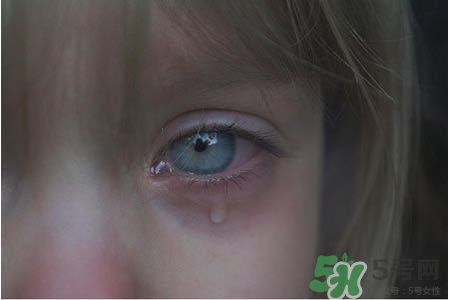 眼睛哭腫了怎么辦？眼睛哭腫了如何快速消腫？