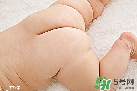 擴肛疼嗎？擴肛手術(shù)會很疼嗎？