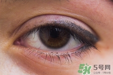 寶寶長(zhǎng)針眼了怎么辦?寶寶長(zhǎng)針眼怎么好的快 寶寶長(zhǎng)針眼了怎么辦?寶寶長(zhǎng)針眼怎么好的快