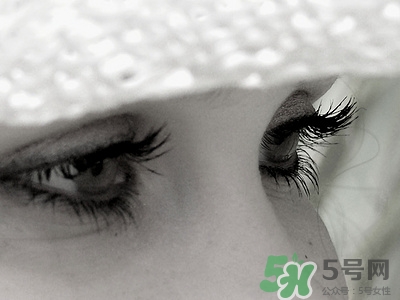 寶寶長(zhǎng)針眼了怎么辦?寶寶長(zhǎng)針眼怎么好的快 寶寶長(zhǎng)針眼了怎么辦?寶寶長(zhǎng)針眼怎么好的快