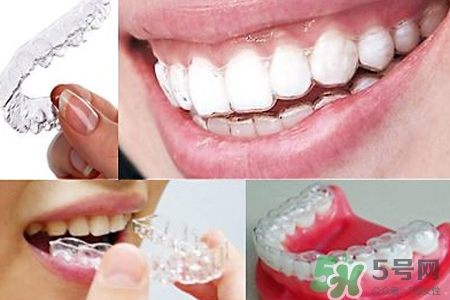 隱形牙套矯正多少錢？隱形牙套多少錢一副？