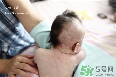 寶寶冬天可以剃光頭嗎?寶寶冬天剃光頭好嗎? 寶寶冬天可以剃光頭嗎?寶寶冬天剃光頭好嗎?