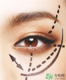 冬天做雙眼皮行嗎?冬天適合割雙眼皮嗎? 冬天做雙眼皮行嗎?冬天適合割雙眼皮嗎?